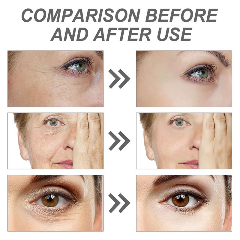 Retinol Remove Wrinkle Face Se - The Ordinary Serum Hyaluronic Acid review and price